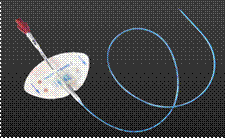 1493962887149686.gif picc.png